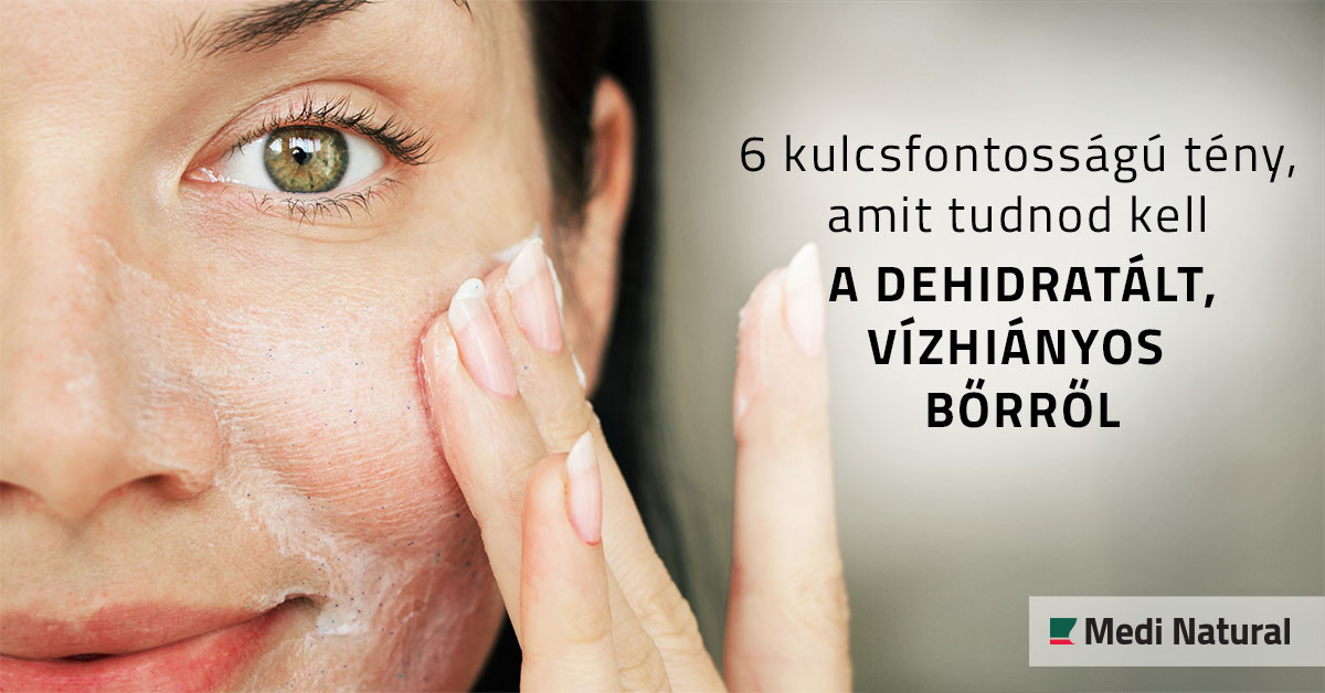 6 kulcsfontosságú tény, amit tudnod kell a dehidratált, vízhiányos bőrről