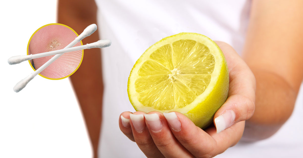 szemolcs-ellen-citromolaj