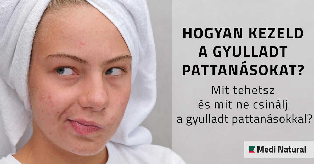 Gyulladt pattanás kezelése - Melyek a legjobb készítmények gyulladt pattanások ellen