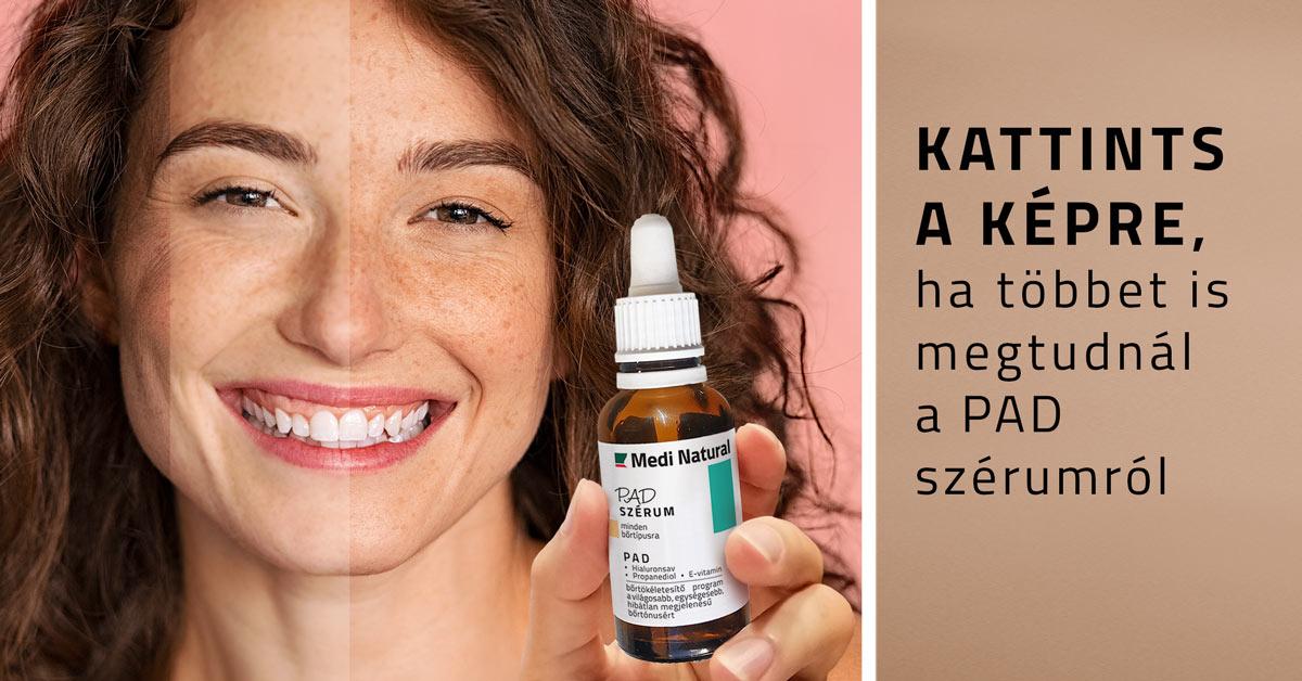 MediNatural PAD szérum - pigmentfoltok ellen