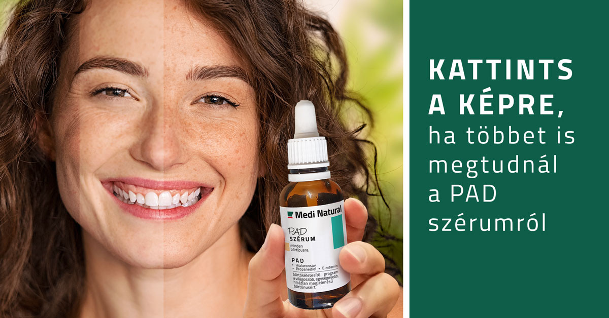 PAD szérum -Potassium Azeloyl Diglycinate - röviden PAD (Azeloglicina®)