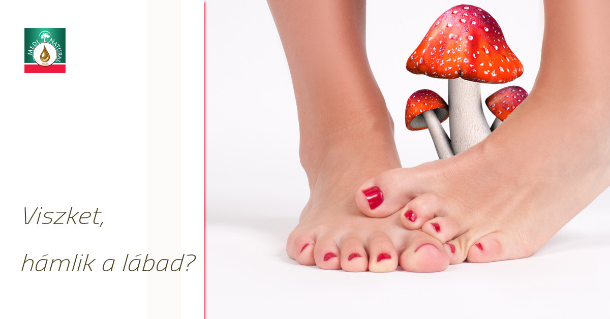 Teafaolaj lábgomba ellen