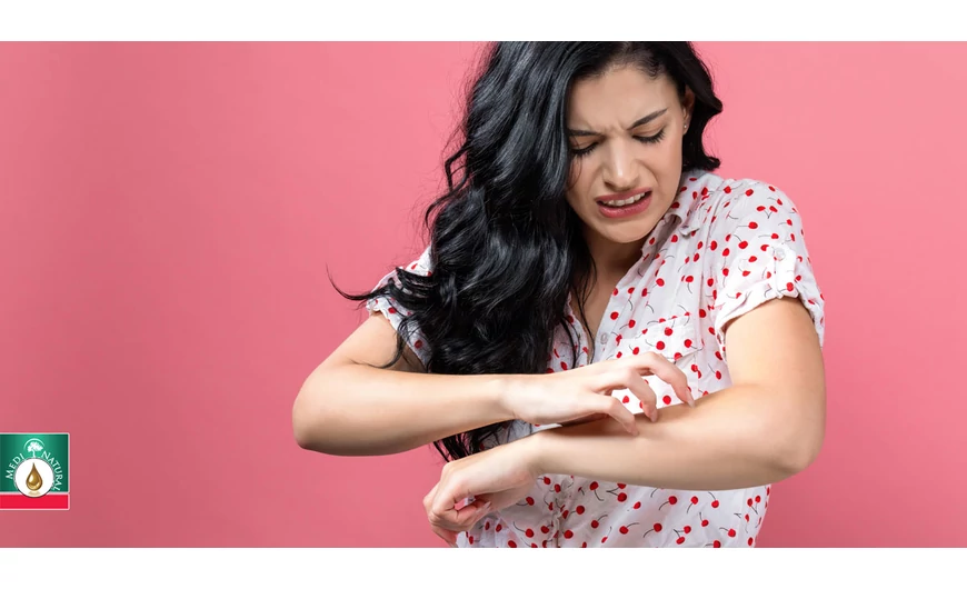 Ekcéma | bizonyított alternatív stratégiák az ekcémás bőr kezelésére