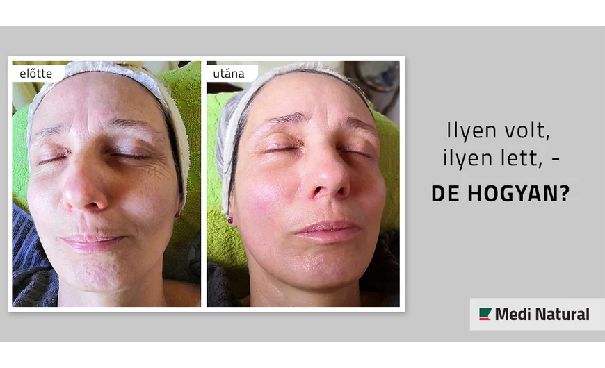 Ilyen volt, ilyen lett, - de hogyan? 