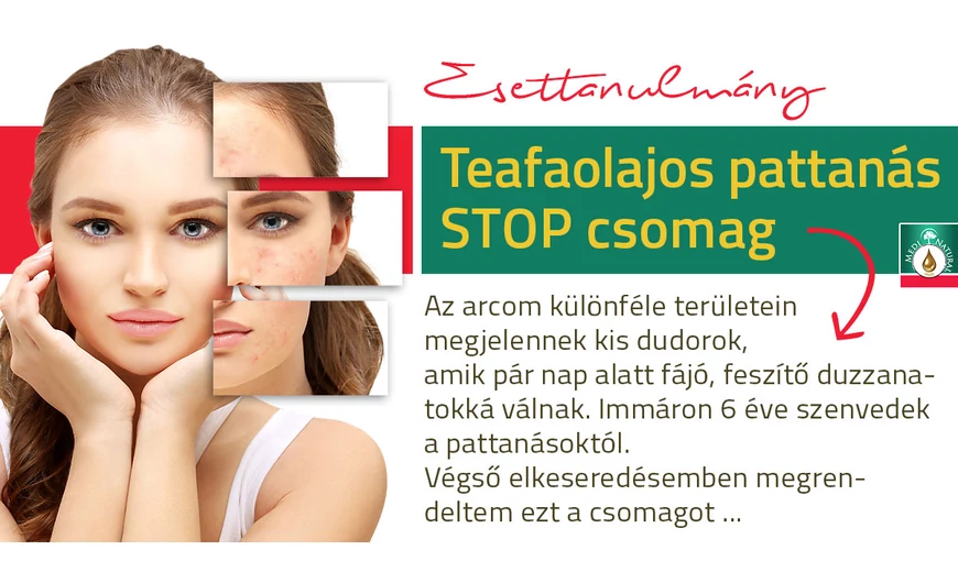 Esettanulmány | hogyan szabadultam meg a pattanásaimtól 