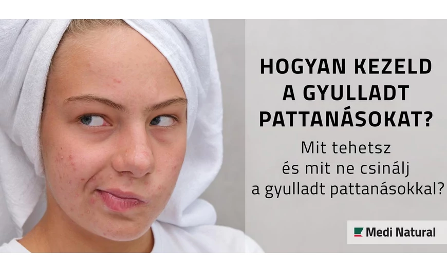 Hogyan kezeld a gyulladt pattanásokat? Mit tehetsz és mit ne csinálj a gyulladt pattanásokkal?