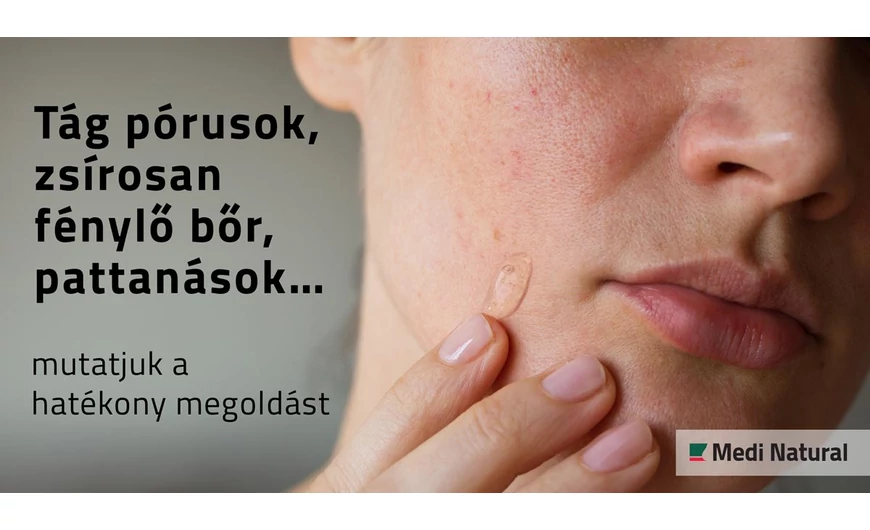 Tág pórusok, zsírosan fénylő bőr, pattanások… | Mutatjuk a hatékony megoldást