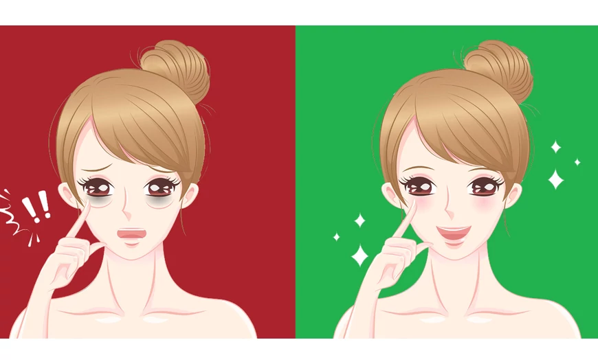 Ne hordj a szemed alatt szatyrokat!