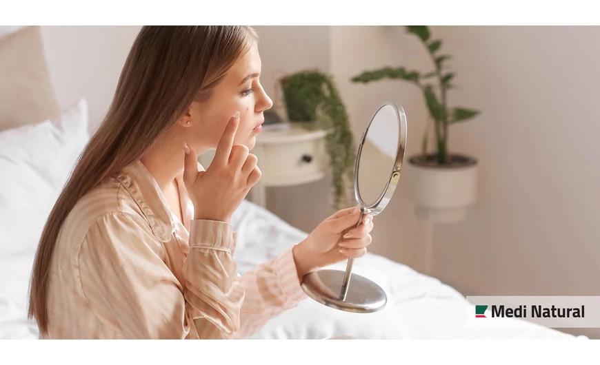 Mi a megoldás, ha zsíros, olajosan fénylő, problémás a bőröd?